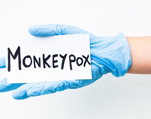 Monkeypox case detected in South Africa » Capital News