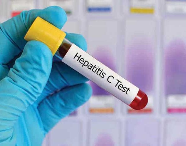 WHO prequalifies first Hepatitis C virus self-test