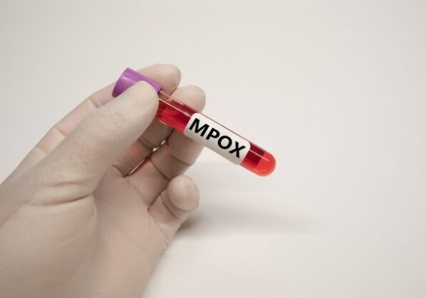 Mpox declared public health emergency in Africa » Capital News