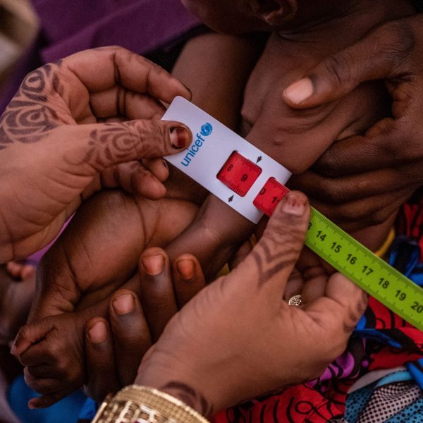 Goalkeepers Report Warns Declining Aid to Africa Threatens Child Survival Amid Malnutrition Crisis » Capital News
