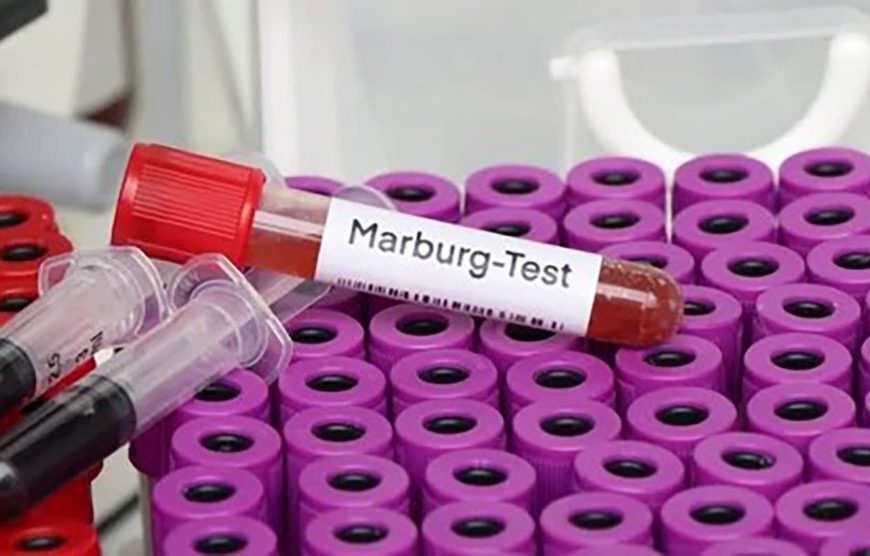 Health Ministry on high alert after Marburg outbreak in Rwanda