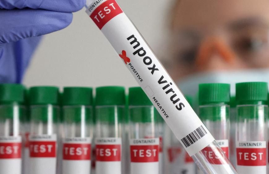 2 new Mpox cases confirmed in Mombasa, tally rises to 26