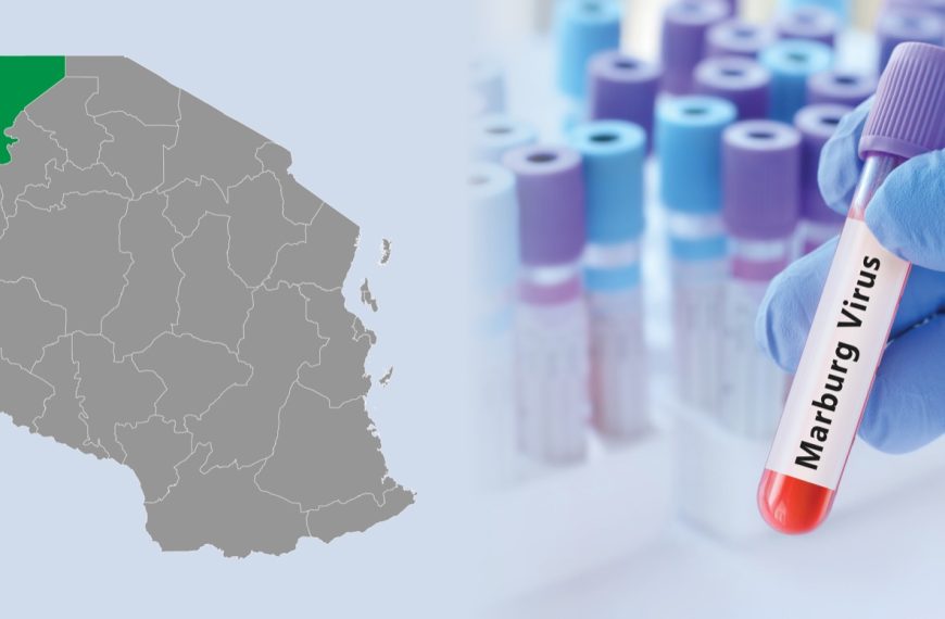 Tanzania confirms Marburg virus outbreak after initial denial » Capital News