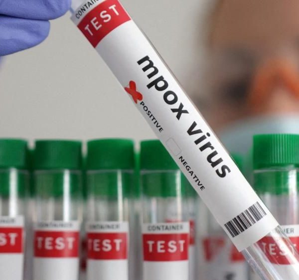 Kenya to roll out Mpox vaccine as cases hit 36