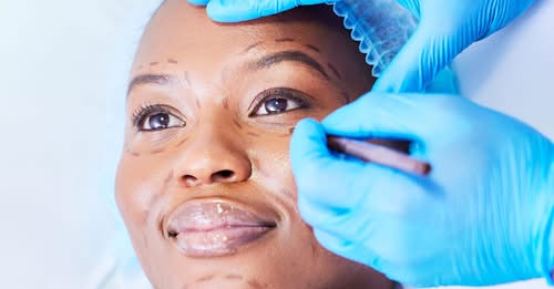 Many Kenyans turn to plastic surgery to reclaim their lives