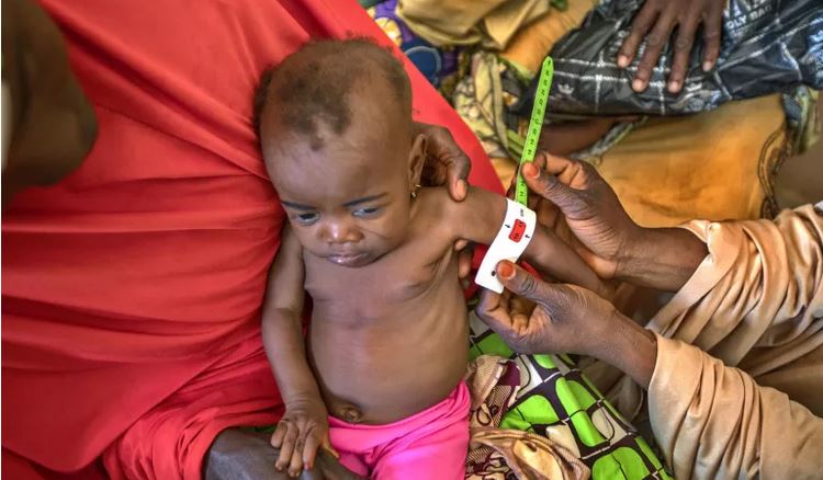 Medieval skeletons reveal the lasting damage of childhood malnutrition – new study » Capital News